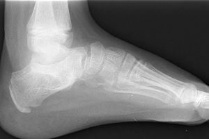 Orthopedic hospitals ankle joint surgery in Germany