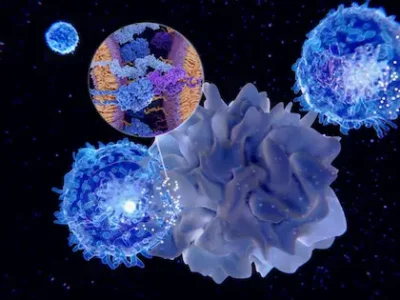 Treatment of pancreatic cancer with dendritic cells in Germany